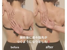 オスマンティエ(Osmantier)/施術ビフォーアフター