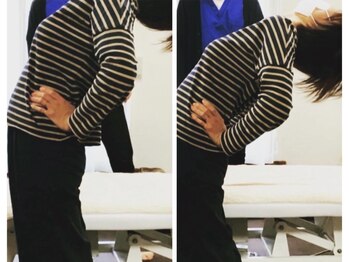 腰痛特化整体院 山本/産後の腰痛before　after