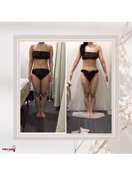 効くラボ 梅田店/3ヶ月で美脚に♪ 下半身集中痩身