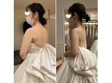 背中・肩甲骨・二の腕はお任せください♪