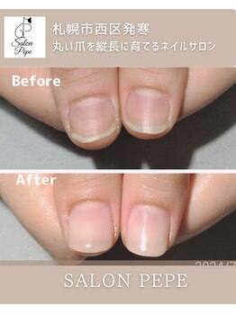 自爪育成で育てた親指