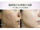 ワイズデュー(Y's Dew)の写真