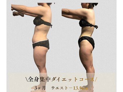 サンテボーテ(Sante Beaute)の写真