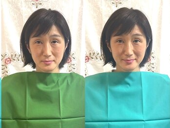 シルビア イン ザ メドー(Silvia in the meadow)/お客様BEFORE AFTER