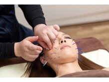 いしはら鍼灸整骨院/美容鍼と筋膜リリース