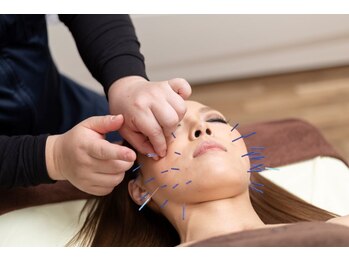 いしはら鍼灸整骨院/美容鍼と筋膜リリース