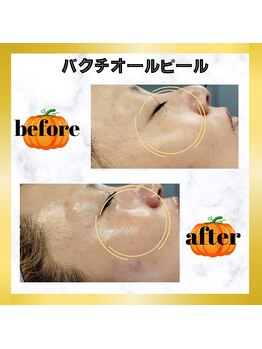 グランディールアン(GRANDIR UN)/バクチオールピール1回目