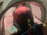 【くすみ、透明感】電気を流す美容鍼＋LED肌管理　初回 6080円