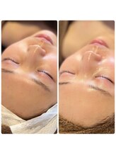 ジャスミン(Jasmine)/陶肌トリートメントで最高艶肌★