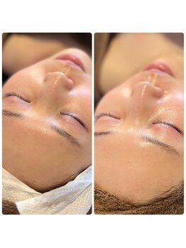 ジャスミン(Jasmine)/陶肌トリートメントで最高艶肌★