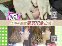 さつま骨格矯正 表参道青山院/上海の番組：東京印象出演