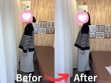 ナオル整体 札幌院(NAORU整体)/札幌円山/整体/姿勢矯正/猫背