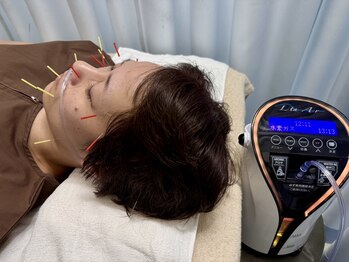 加島鍼灸接骨院の写真/美容業界大注目の【水素美容鍼】【ハリウッド式美容鍼】美肌効果&疲労解消も叶える魔法のような鍼灸施術◎