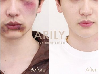 アリリィ(ARILY)/ARILY after care salon