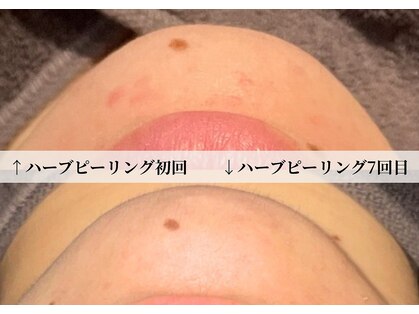 エルヴェ(Eleve)の写真