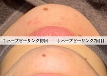 エルヴェ(Eleve)