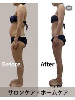 リヴェーヌ 呉羽店(Riverne)の写真/筋膜リリースでガツンと！痩身マシンでセル脂肪分解・脂肪術を組み合わせでナイスボディへ◎