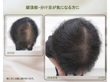 サロンラグナ(Salon Laguna)/【頭皮ケア】施術結果（2回目）
