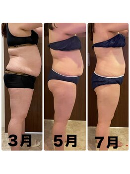 あきくに整骨院 美容整体院/T様　途中経過