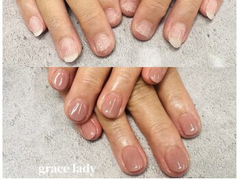 グレースレディ/手全体綺麗に