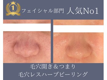 エノアビューティー(ENOA beauty)/フェイシャル人気NO1