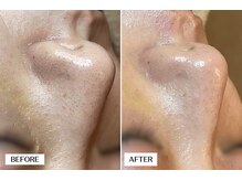 エングラッシー(en glassy)/BEFORE AFTER　30代