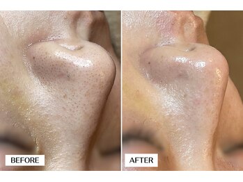 エングラッシー(en glassy)/BEFORE AFTER　30代