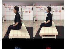 ストレチックス 近江八幡店/BeforeAfter