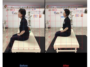 ストレチックス 近江八幡店/BeforeAfter