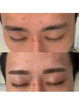 ビュー テンジン 天神 大名(VIEW TENJIN)/アイブロウ（眉毛）WAX脱毛