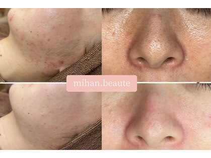 ミハン ボーテ(mihan.beaute)の写真