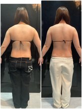 ビオラス 高崎店/20代女性痩身ビフォーアフター