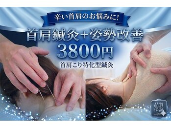 西宮しおり鍼灸整骨院 整体院の写真/【！辛い首肩こりのお悩みの方必見！】首肩鍼灸＋姿勢改善《3800円》首肩の凝りに直接アプローチ♪
