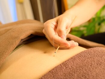 ととろはりきゅう院/背中のお灸で内臓の働きUP！