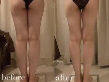 上野エステサロン レア(Lea)/痩身