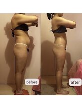 ディタ アンド ボーン(DITA&BORN)/痩身全身