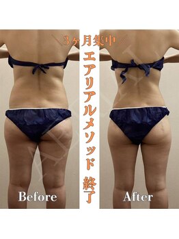 エアリアル 武雄店/エアリアルメソッド!