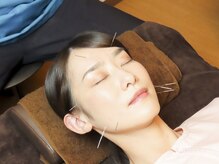 養美ラボ(YOBI Labo)の雰囲気（ピンポイントで鍼を打つことで小顔効果抜群です！）