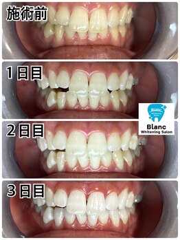 ブラン 心斎橋店(Blanc)/年間メンテナンス付プラン実例2