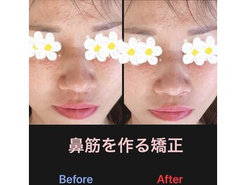 美容矯正サロン レレポノ(LELEPONO)/