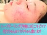 初心者「学割U24」ニキビケア☆毛穴ちゃん、テカリちゃん救います★通常9,970