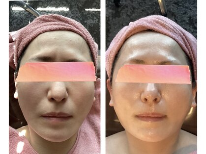 ブリス(bliss)の写真