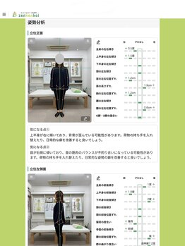 カイロプラクティック輝/AI姿勢診断　正面の姿勢