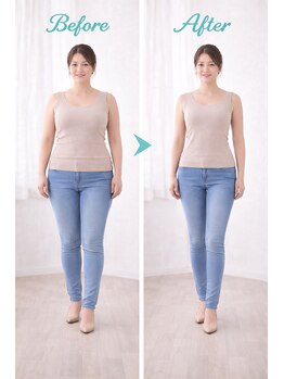 アプロ(Aphro)/別人級スタイル