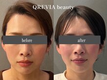 クレヴィアビューティー(QREVIA beauty)
