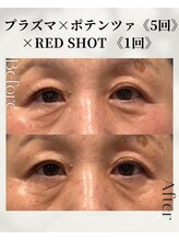 ネイルアンドアンチエイジングドゥシール(Docile)/60代女性｜目元脂肪・クマ改善