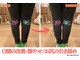 ニノ治療院(Nino治療院)の写真/O脚改善・お尻・太もものサイズダウンしたい女性にオススメ！
