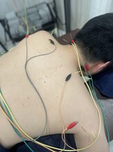 カラダサポート鍼灸接骨院 太田藤阿久店/鍼