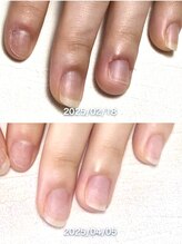 ポメロ(POMELO)/わずか１ヶ月半でもこの変化！