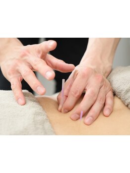 鍼灸施術を受けたい